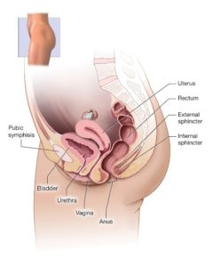 pelvic organ prolapse